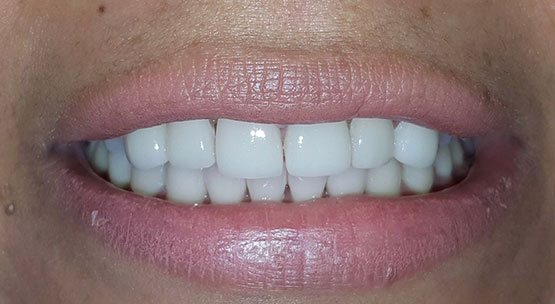 Acevedo Dental Group Cosmetic Dentistry