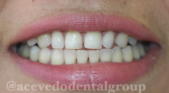 Acevedo Dental Group Cosmetic Dentistry