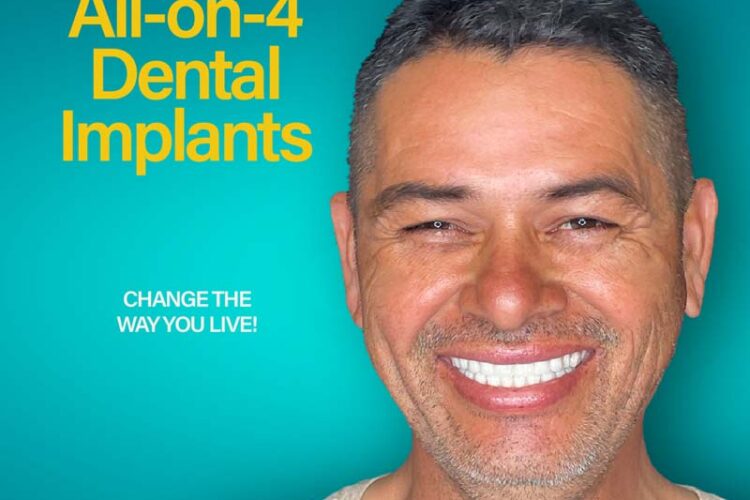 dental_services_all_on_4_Dental_Implants_montebello_ontario_santa_ana