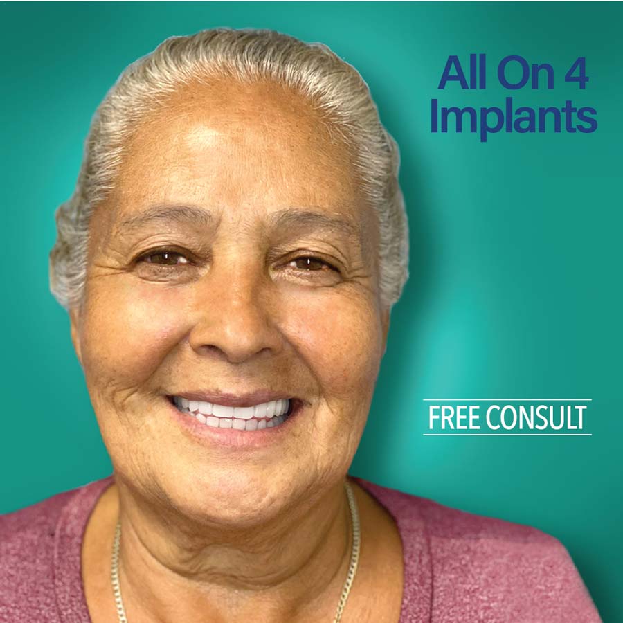 free consultation - dental implants