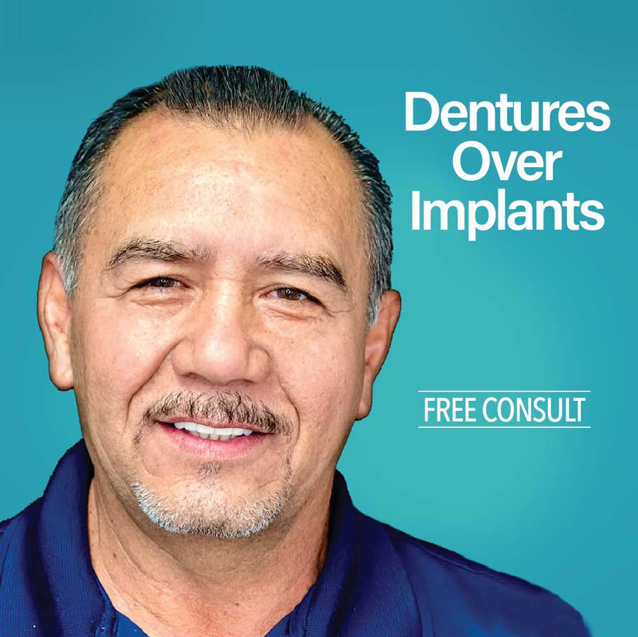 free consultation implant supported dentures
