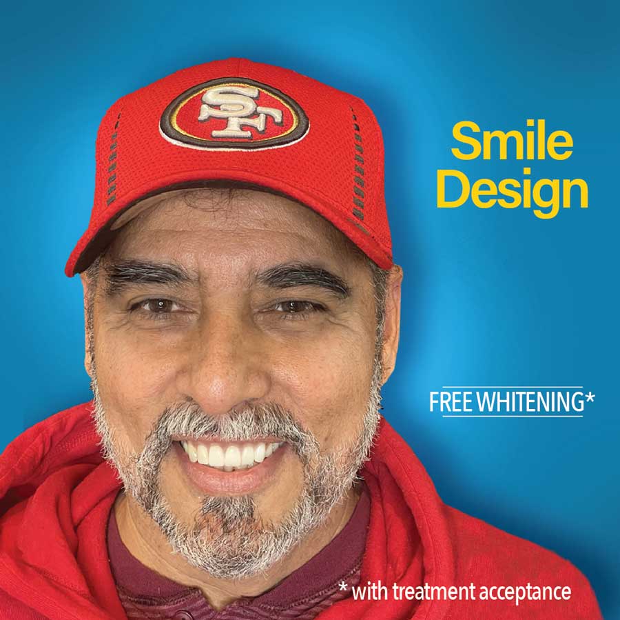 free teeth whitening - Smile design