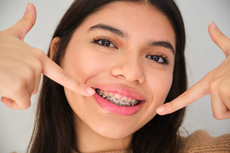 orthodontic braces smiling patient representing orthodontic treatment in montebello ontario santa ana by acevedo dental